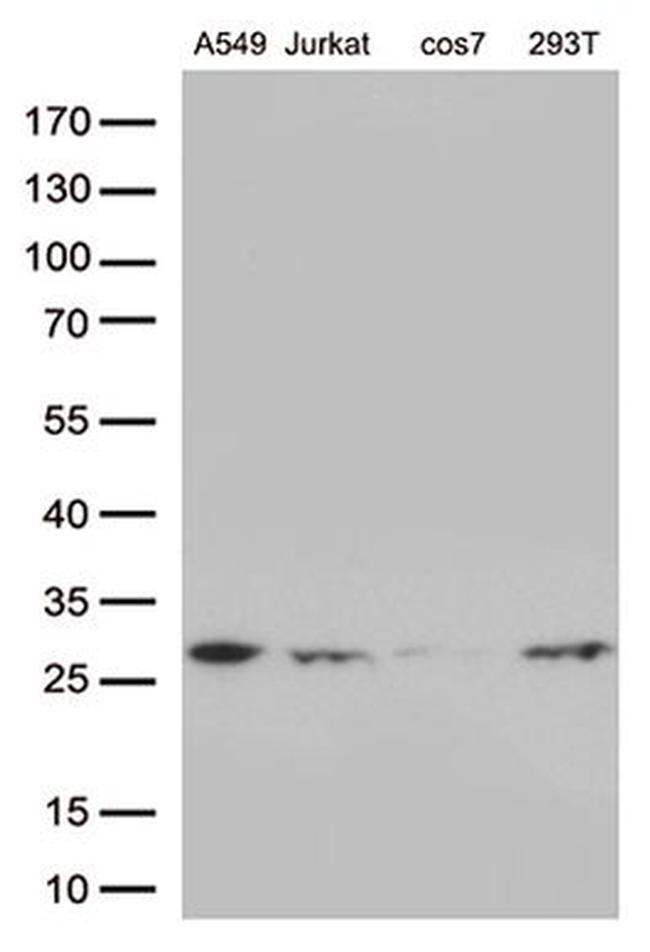 BCL2 Antibody in Western Blot (WB)