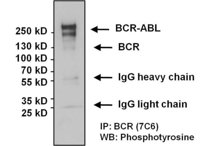 BCR-ABL Antibody in Immunoprecipitation (IP)