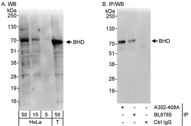 BHD Antibody in Western Blot (WB)