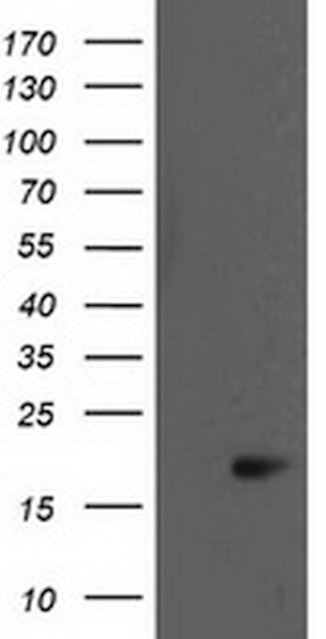 BIRC5/Survivin Antibody in Western Blot (WB)