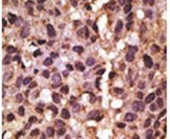 BNIP3 Antibody in Immunohistochemistry (Paraffin) (IHC (P))