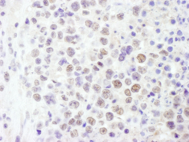 BRG1/SMARCA4 Antibody in Immunohistochemistry (IHC)