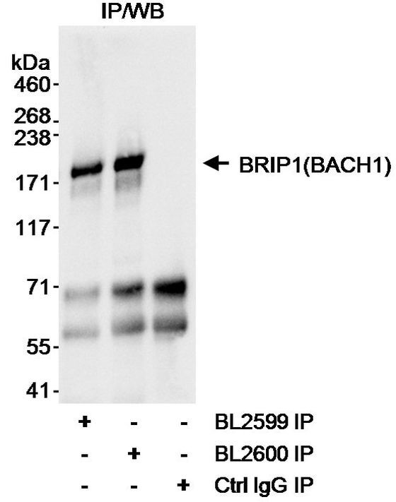 BRIP1 Antibody in Immunoprecipitation (IP)