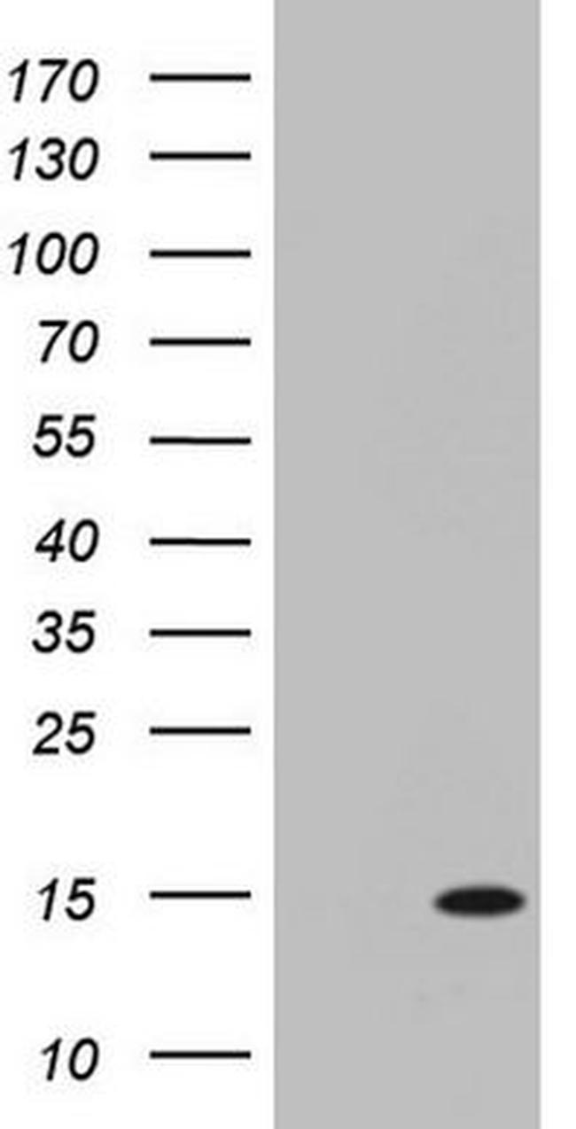 C11orf67 Antibody in Western Blot (WB)