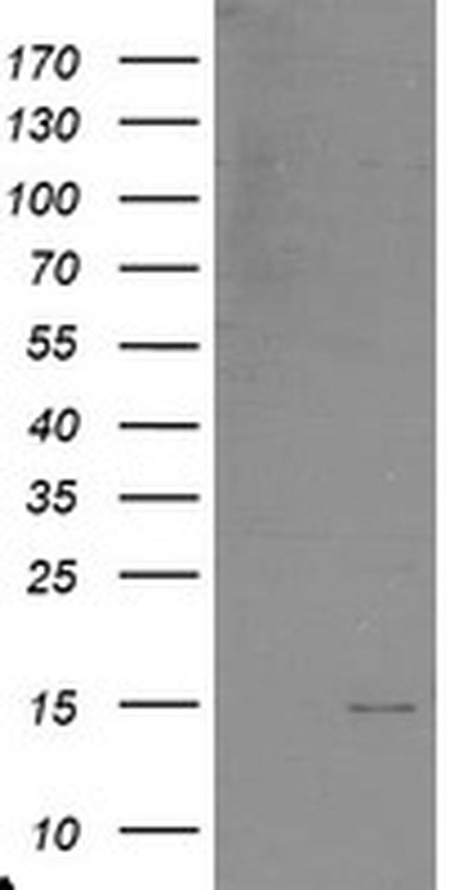 C17orf37 Antibody in Western Blot (WB)