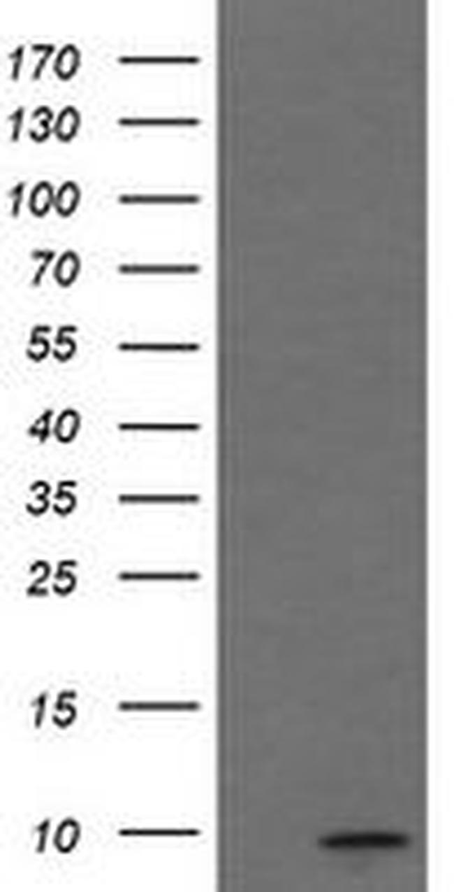 C1orf151 Antibody in Western Blot (WB)