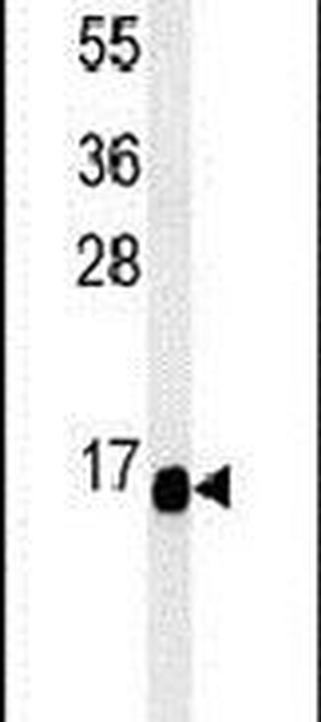 C1orf186 Antibody in Western Blot (WB)
