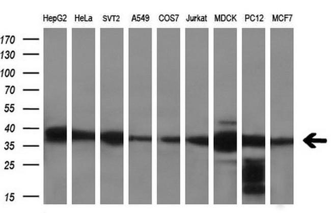C21orf59 Antibody in Western Blot (WB)