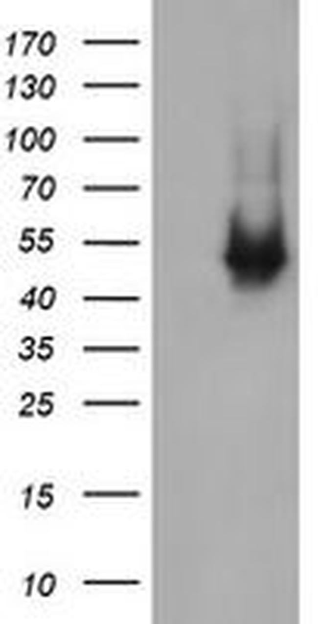 C2orf62 Antibody in Western Blot (WB)