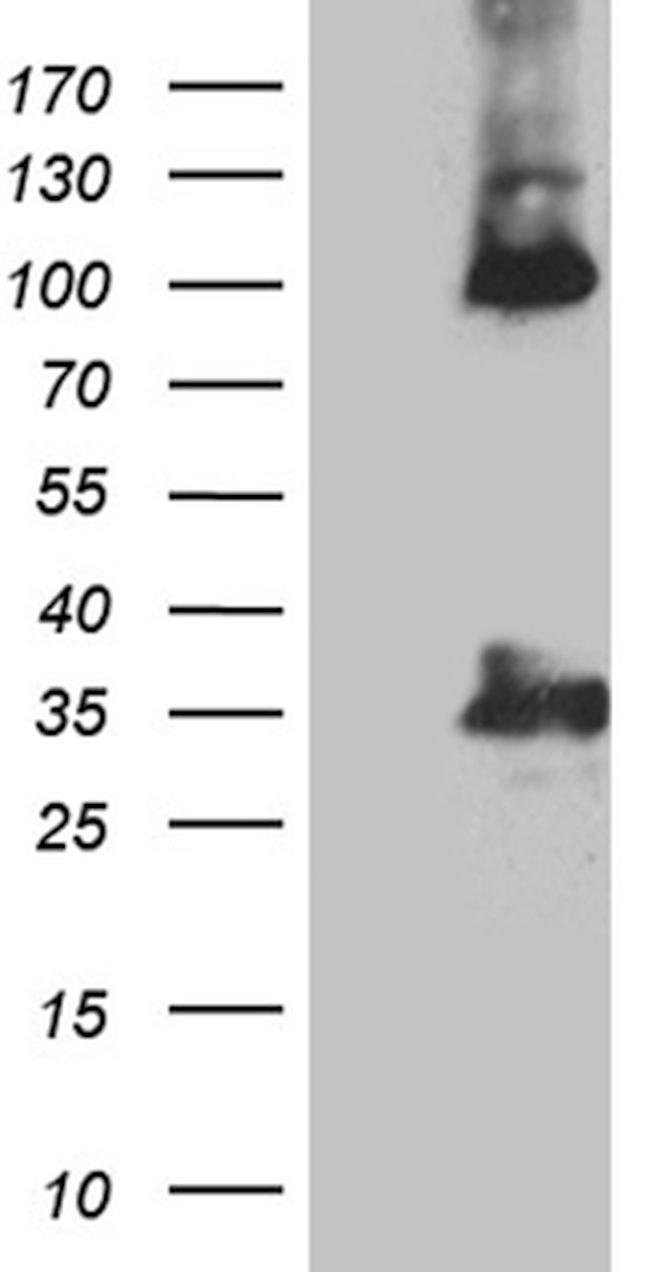 CALB2 Antibody in Western Blot (WB)