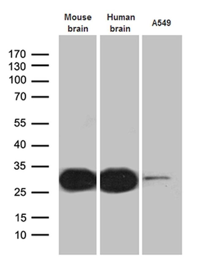 CALB2 Antibody in Western Blot (WB)