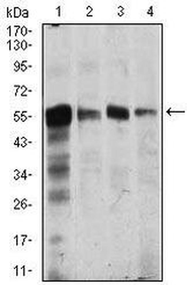 CaMKIV Antibody in Western Blot (WB)