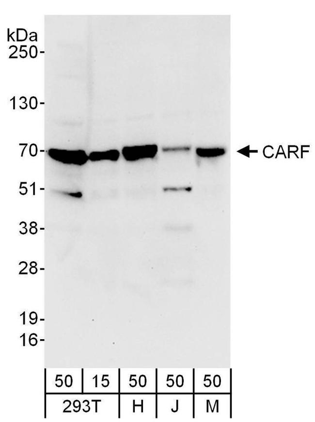 CARF Antibody in Western Blot (WB)