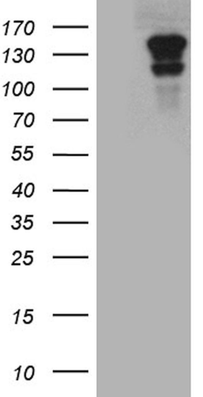 CASKIN2 Antibody in Western Blot (WB)
