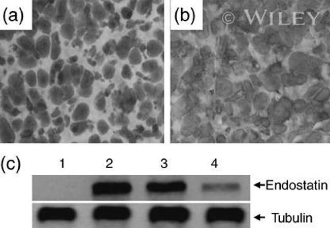 Endostatin Antibody in Western Blot (WB)