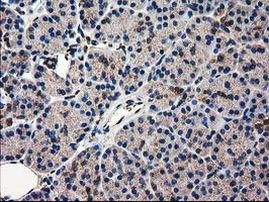 CAT Antibody in Immunohistochemistry (Paraffin) (IHC (P))