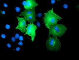CCM2 Antibody in Immunocytochemistry (ICC/IF)
