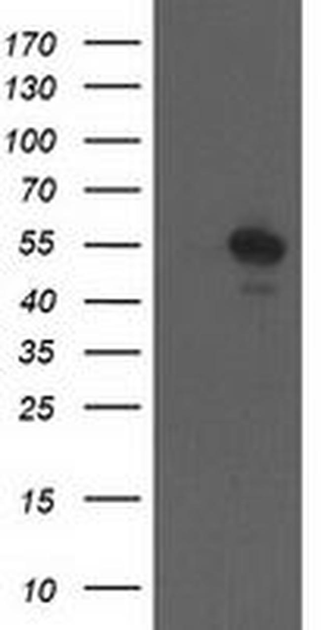 CCM2 Antibody in Western Blot (WB)