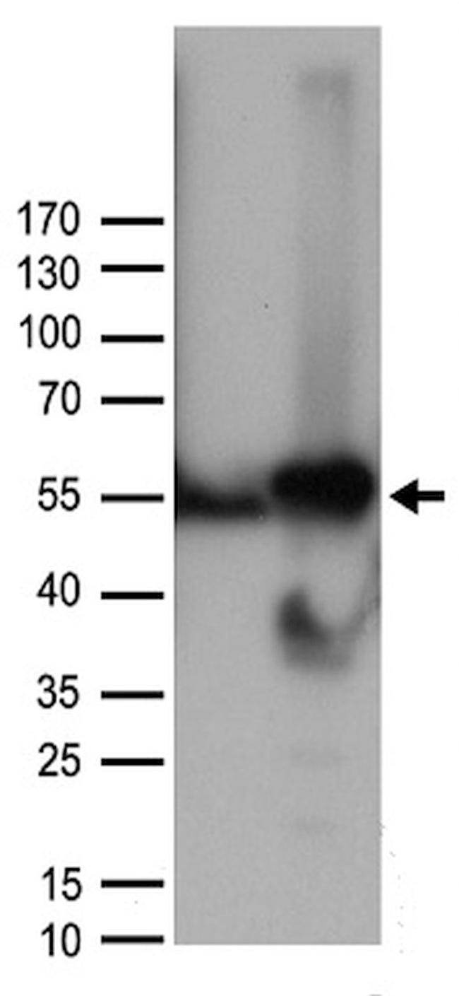 CCNA2 Antibody in Western Blot (WB)