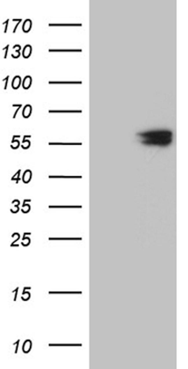 CCT4 Antibody in Western Blot (WB)