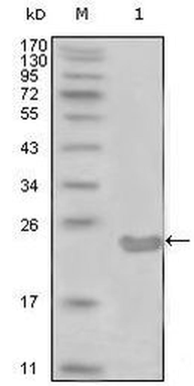 CD10 Antibody in Western Blot (WB)