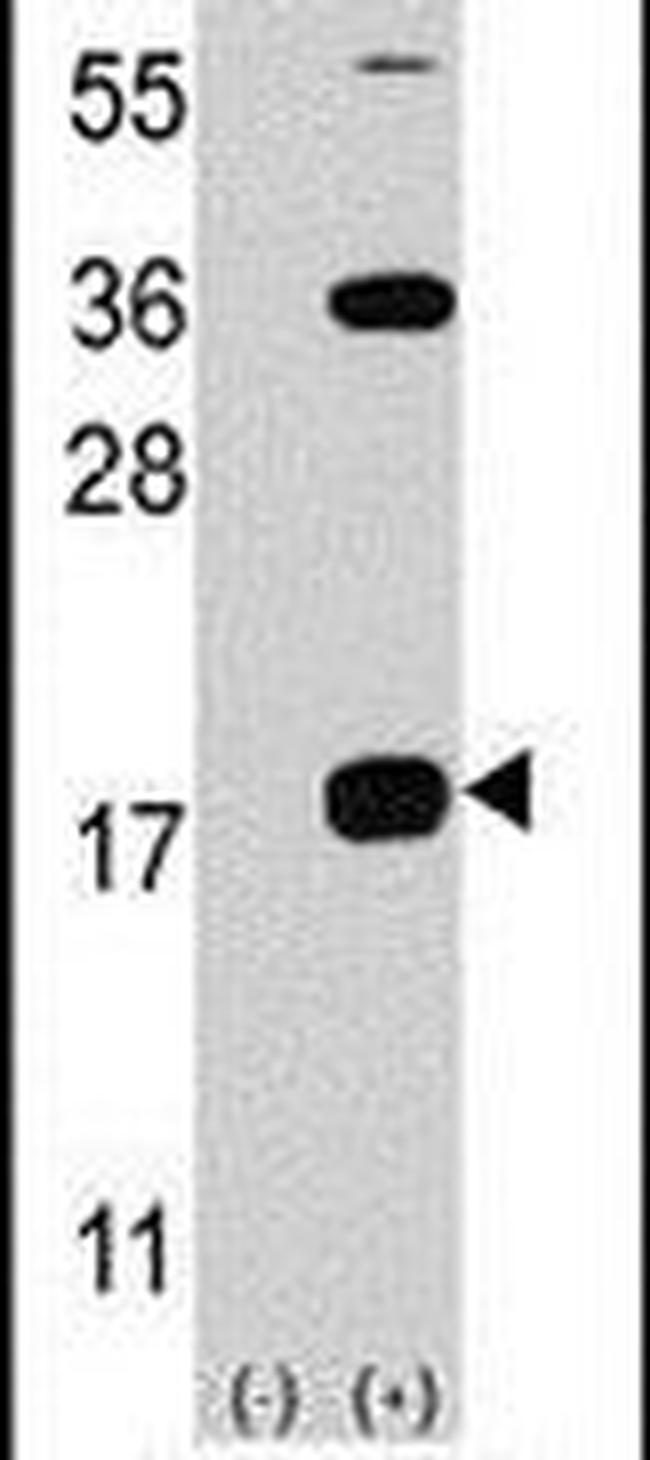 CD3z Antibody in Western Blot (WB)