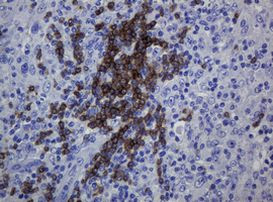 CD79A Antibody in Immunohistochemistry (Paraffin) (IHC (P))