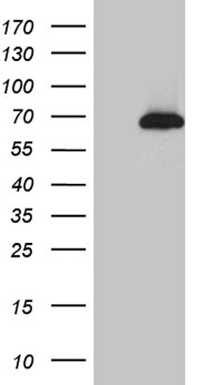 CDC45 Antibody in Western Blot (WB)