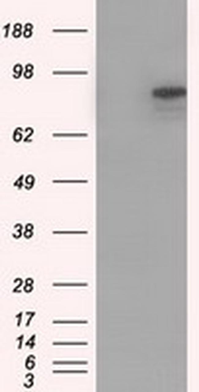 CDH13 Antibody in Western Blot (WB)