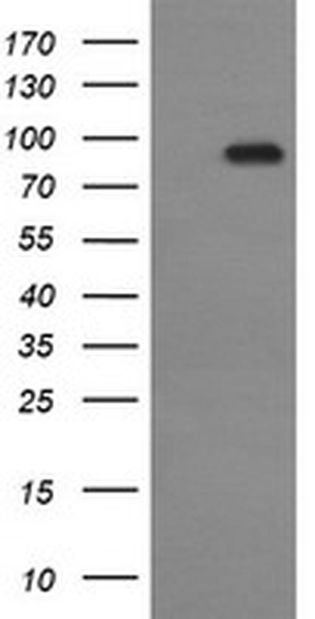 CDH3 Antibody in Western Blot (WB)