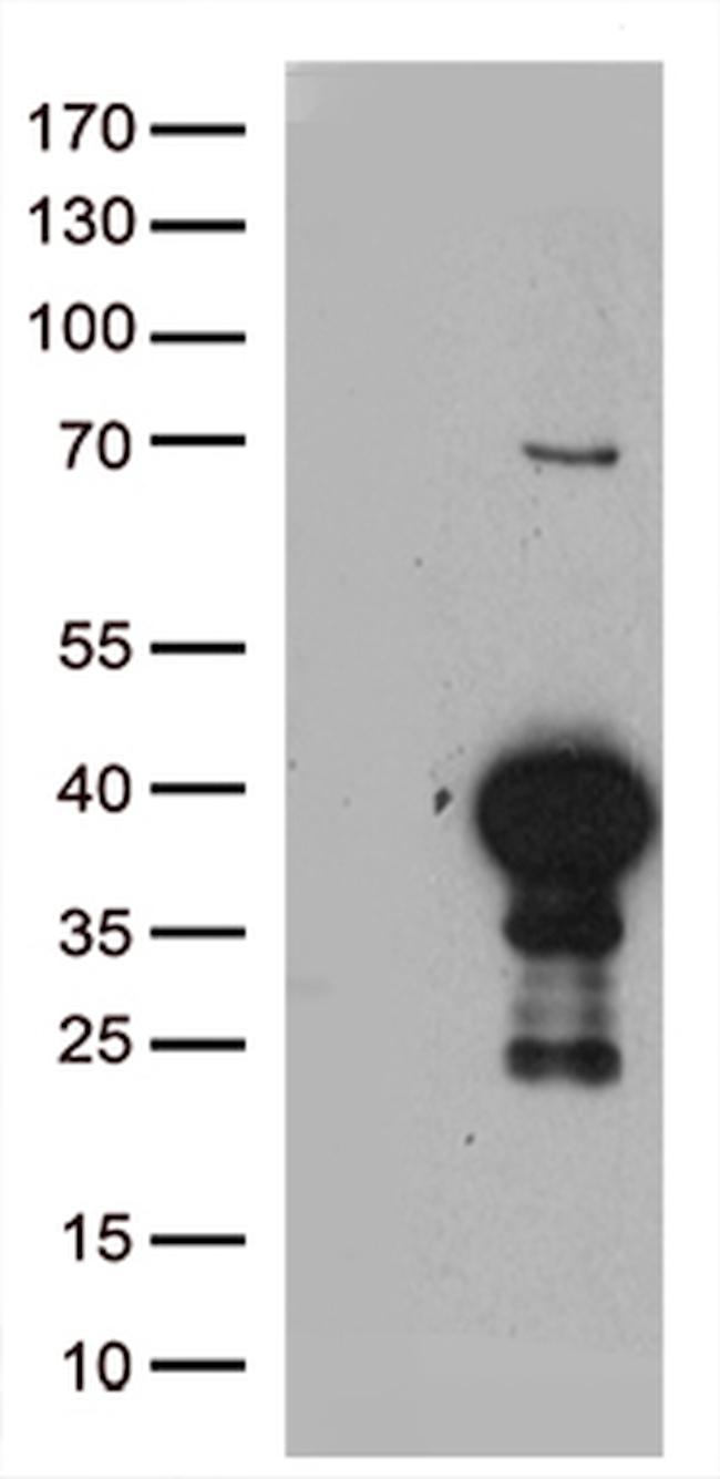 CDK15 Antibody in Western Blot (WB)
