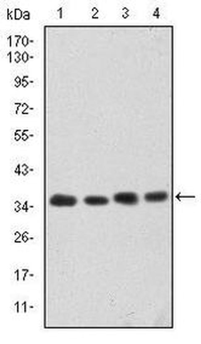 CDK5 Antibody in Western Blot (WB)