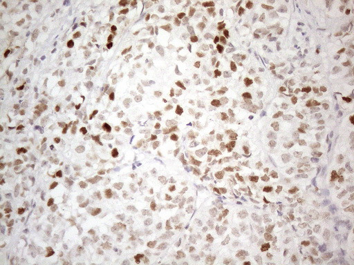 CDKN1A Antibody in Immunohistochemistry (Paraffin) (IHC (P))