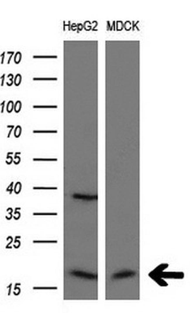 CDKN1A Antibody in Western Blot (WB)