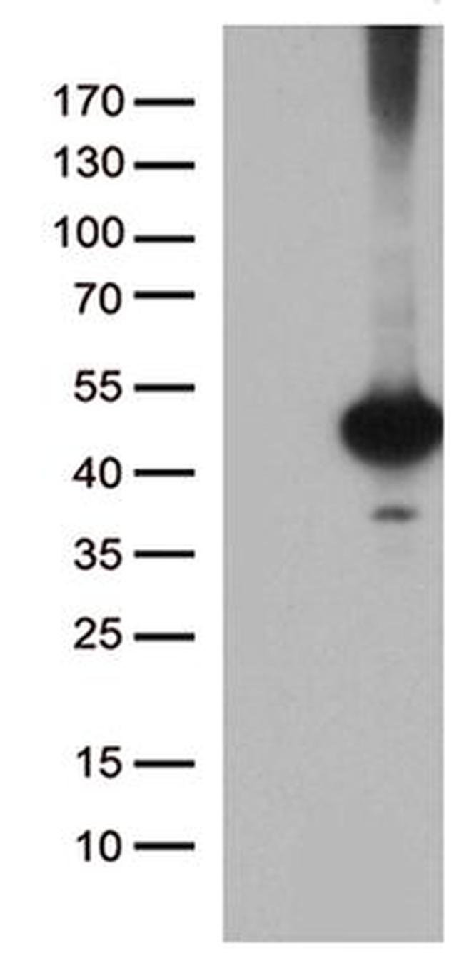CELF6 Antibody in Western Blot (WB)