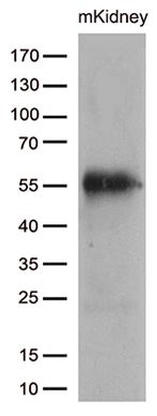 CELF6 Antibody in Western Blot (WB)