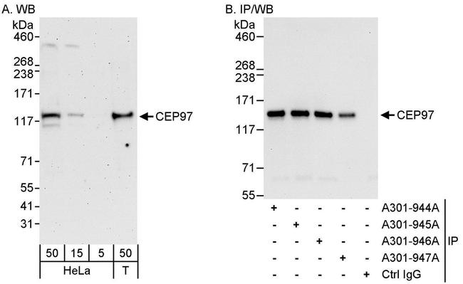 CEP97 Antibody in Western Blot (WB)