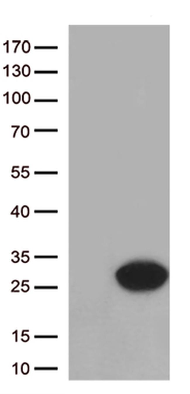 Cytoglobin (CYGB) Antibody in Western Blot (WB)