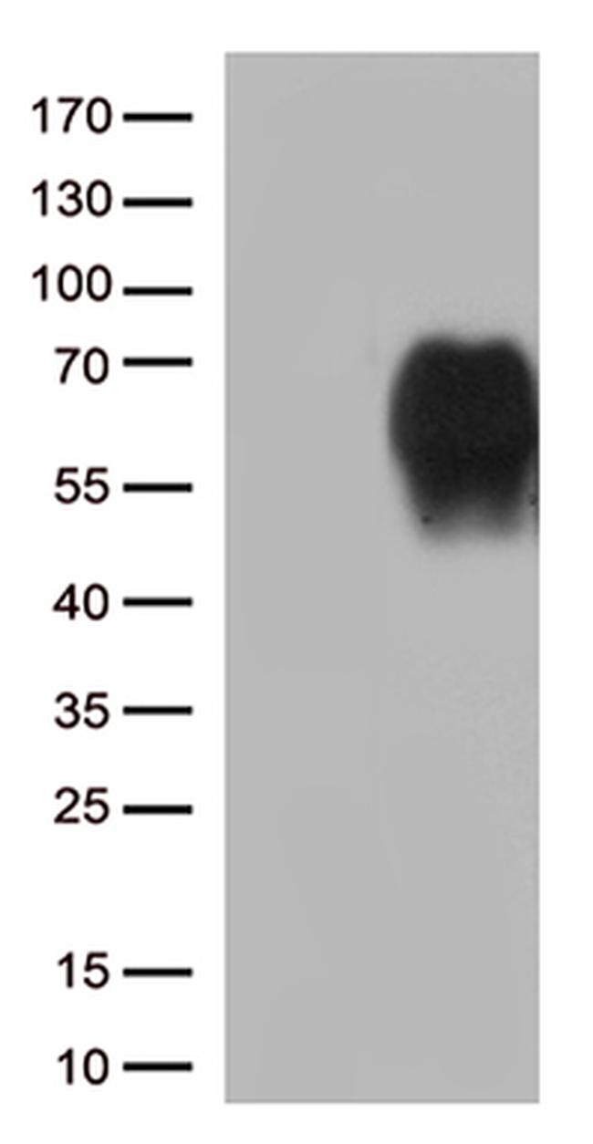 B7-2 (CD86) Antibody in Western Blot (WB)