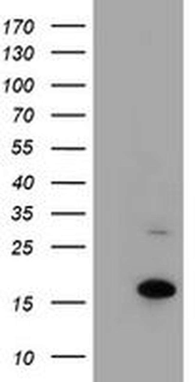 CHCHD5 Antibody in Western Blot (WB)