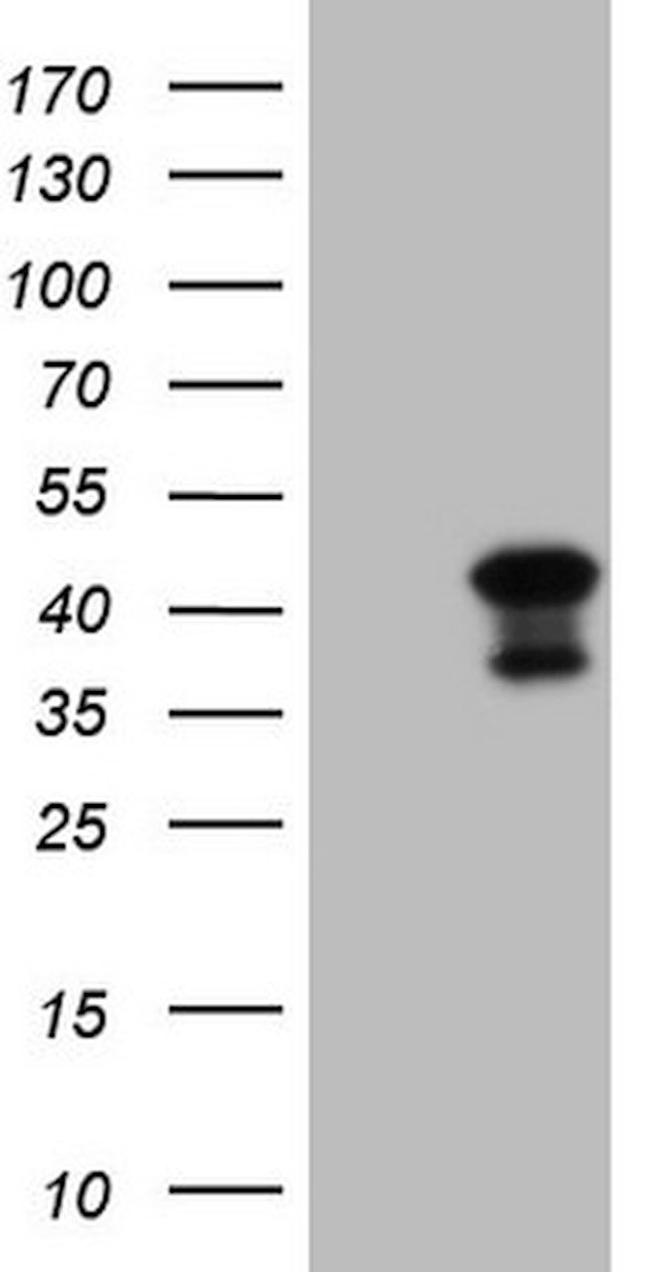 CIAPIN1 Antibody in Western Blot (WB)