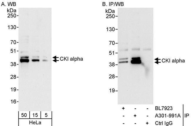 CKI alpha Antibody in Western Blot (WB)