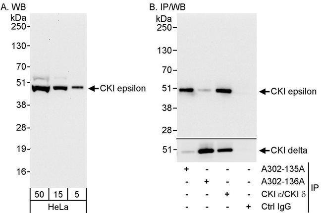 CKI epsilon Antibody in Western Blot (WB)