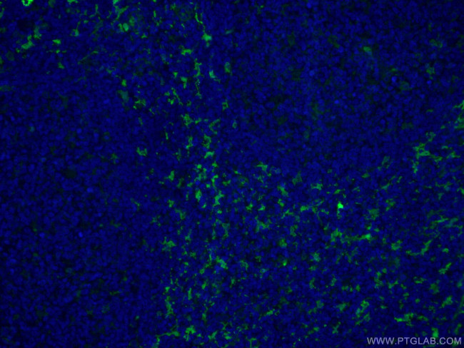 Fascin Antibody in Immunohistochemistry (PFA fixed) (IHC (PFA))