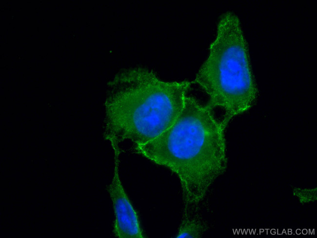 Phospho-RIPK1 (Ser161) Antibody in Immunocytochemistry (ICC/IF)