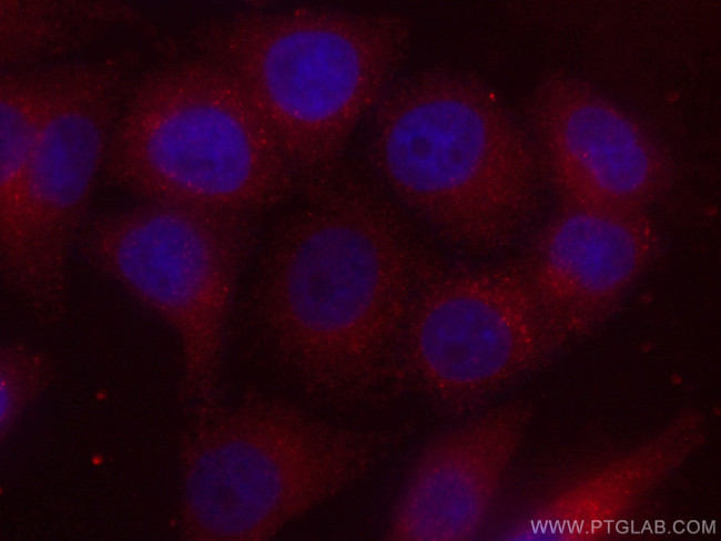 GSTO1 Antibody in Immunocytochemistry (ICC/IF)