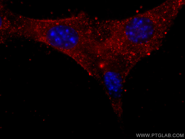 Myosin Light Chain 2 Antibody in Immunocytochemistry (ICC/IF)