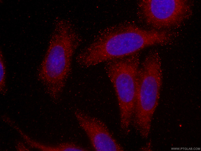 SMN-Exon7 Antibody in Immunocytochemistry (ICC/IF)