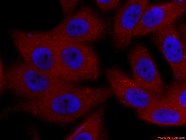 ZC3HAV1 Antibody in Immunocytochemistry (ICC/IF)