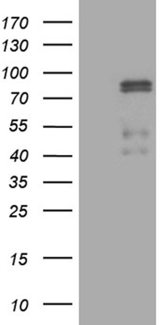 CLIP4 Antibody in Western Blot (WB)